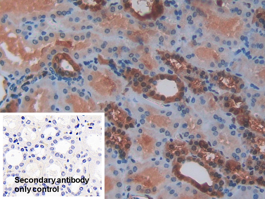 Polyclonal Antibody to S100 Calcium Binding Protein (S100)