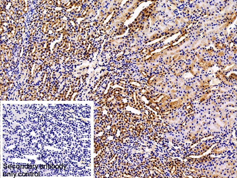 Polyclonal Antibody to S100 Calcium Binding Protein (S100)