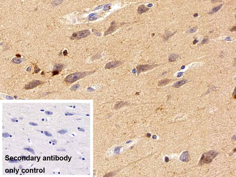 Polyclonal Antibody to S100 Calcium Binding Protein (S100)