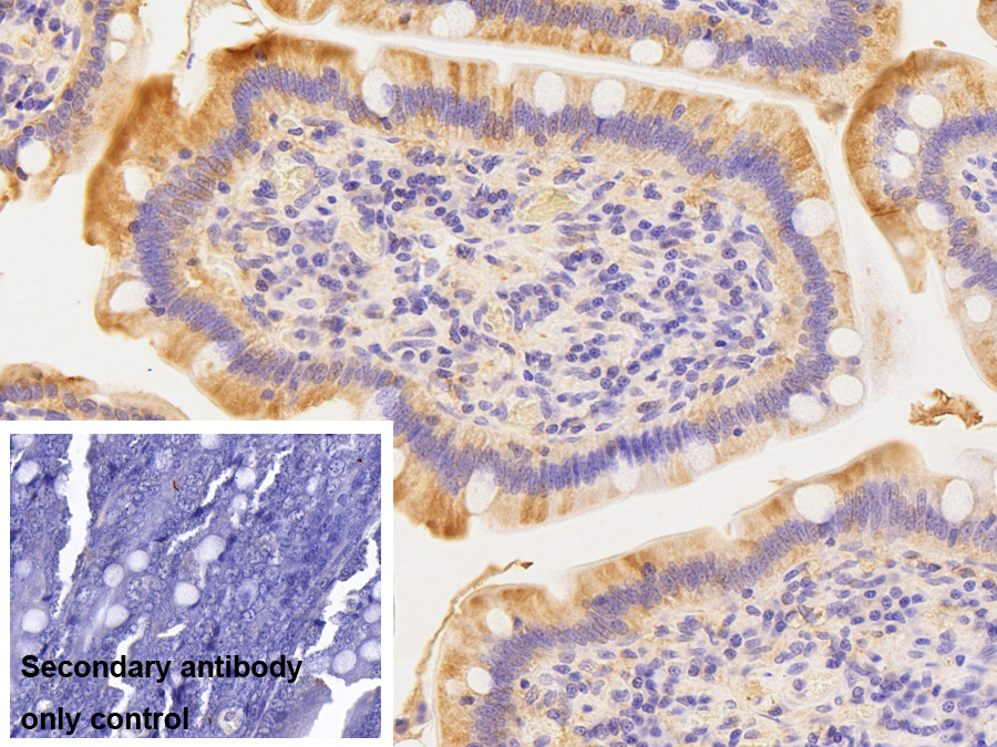 Polyclonal Antibody to Bone Morphogenetic Protein 2 (BMP2)