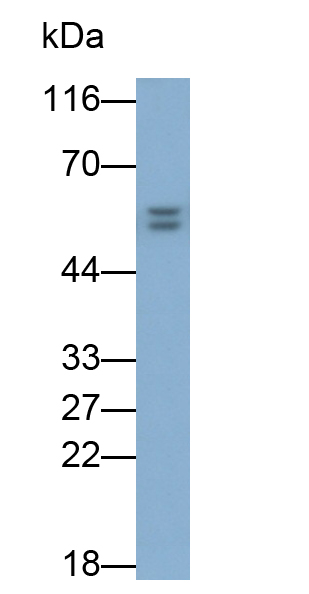 Polyclonal Antibody to Bone Morphogenetic Protein 2 (BMP2)