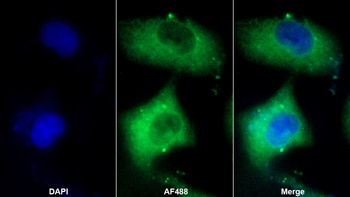 Polyclonal Antibody to Bone Morphogenetic Protein 4 (BMP4)