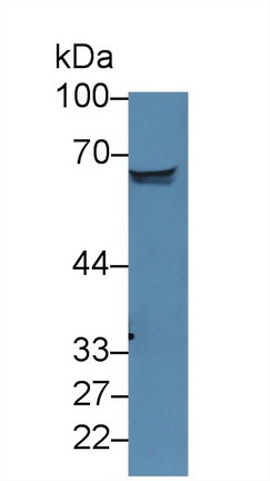 Polyclonal Antibody to Bone Morphogenetic Protein Receptor 1A (BMPR1A)