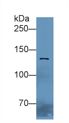 Polyclonal Antibody to E-cadherin