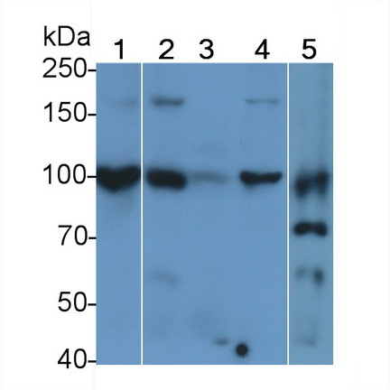 Polyclonal Antibody to E-cadherin