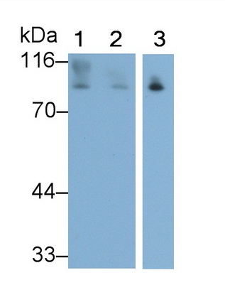 Polyclonal Antibody to E-cadherin