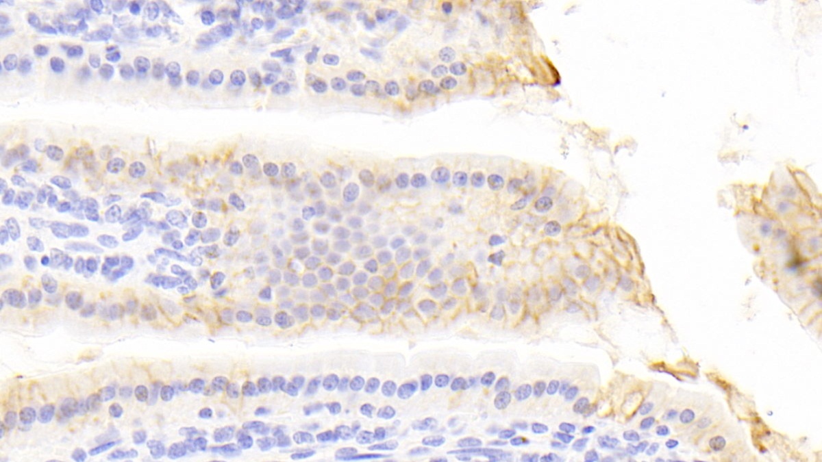 Polyclonal Antibody to E-cadherin