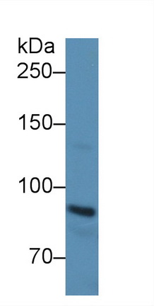 Polyclonal Antibody to E-cadherin