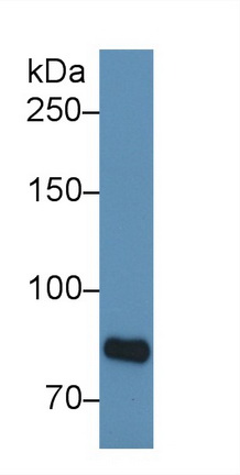 Polyclonal Antibody to E-cadherin