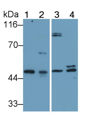 Polyclonal Antibody to Endothelial protein C receptor (EPCR)