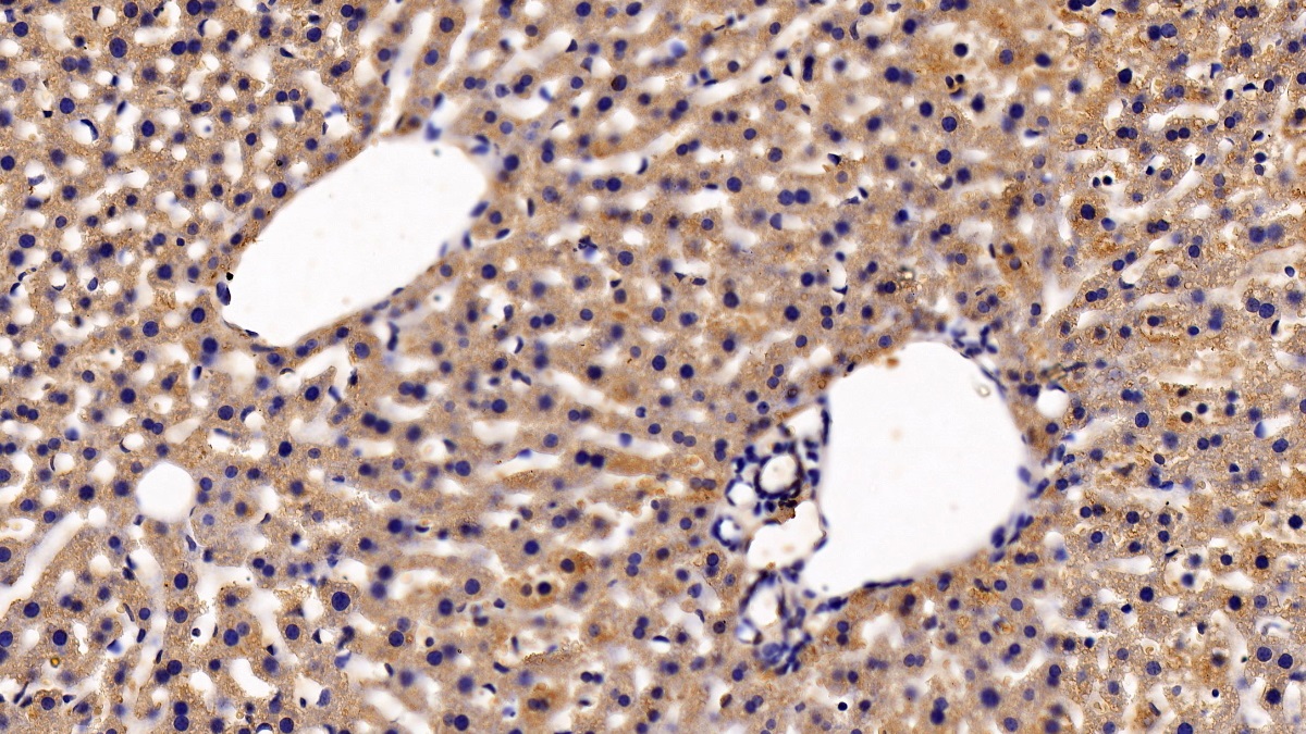 Polyclonal Antibody to Erythropoietin Receptor (EPOR)