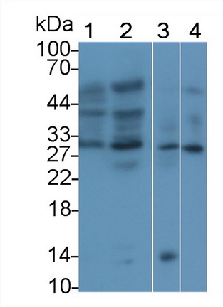 Polyclonal Antibody to Erythropoietin (EPO)