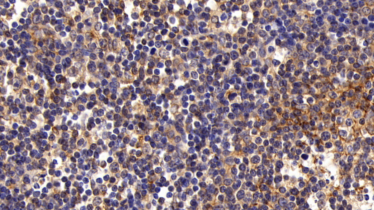 Polyclonal Antibody to Factor Related Apoptosis (FAS)
