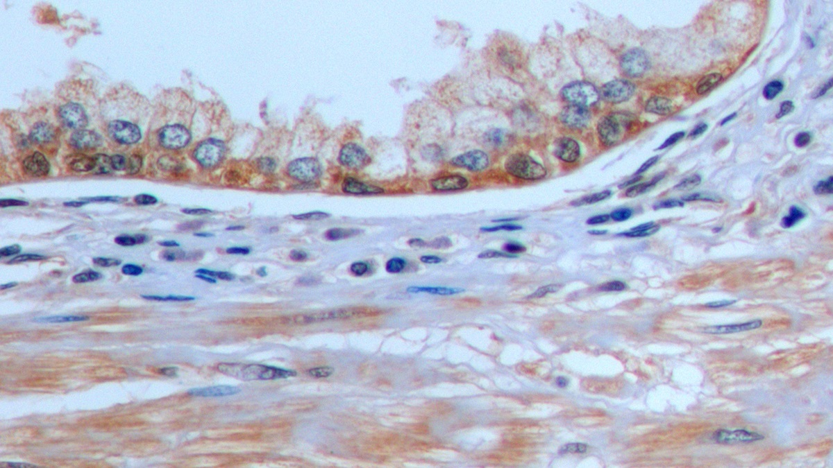 Polyclonal Antibody to Factor Related Apoptosis (FAS)