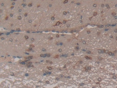 Polyclonal Antibody to Factor Related Apoptosis (FAS)