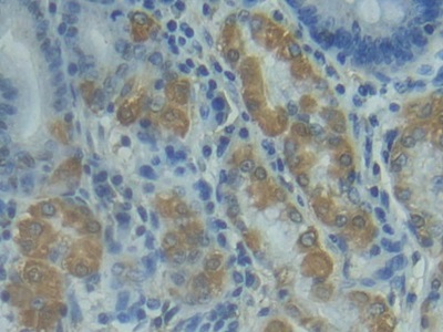 Polyclonal Antibody to Factor Related Apoptosis Ligand (FASL)