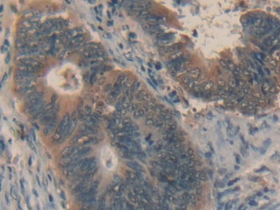 Polyclonal Antibody to Factor Related Apoptosis Ligand (FASL)