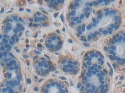 Polyclonal Antibody to Factor Related Apoptosis Ligand (FASL)