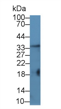 Polyclonal Antibody to Factor Related Apoptosis Ligand (FASL)