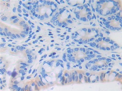 Polyclonal Antibody to Fibroblast Growth Factor 6 (FGF6)