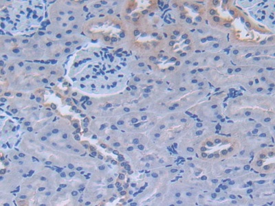 Polyclonal Antibody to Fibronectin (FN)