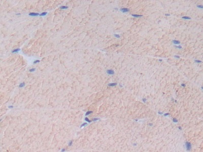 Polyclonal Antibody to Fibronectin (FN)