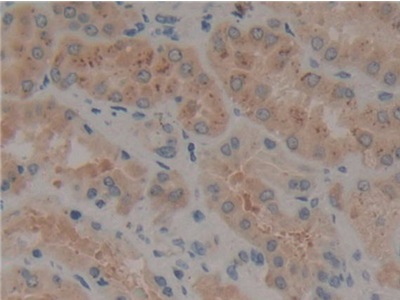 Polyclonal Antibody to FMS Like Tyrosine Kinase 3 (Flt3)