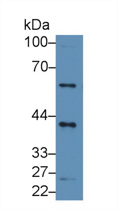 Polyclonal Antibody to Chemokine C-X3-C-Motif Ligand 1 (CX3CL1)