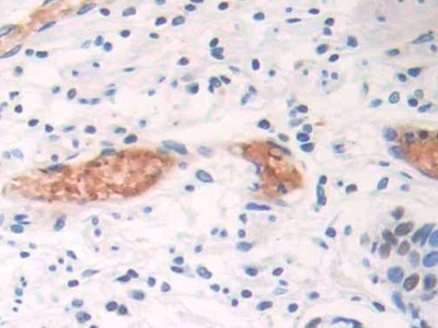 Polyclonal Antibody to Chemokine C-X3-C-Motif Ligand 1 (CX3CL1)