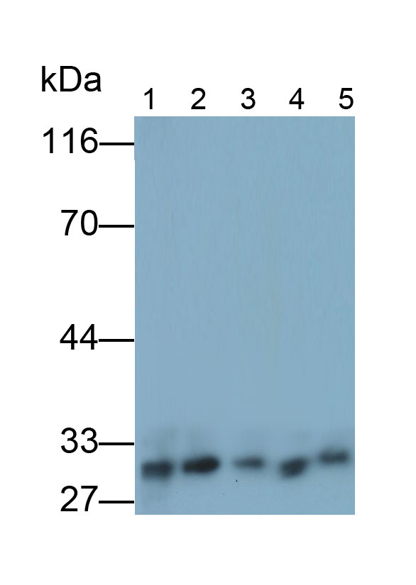 Polyclonal Antibody to Chemokine C-X3-C-Motif Ligand 1 (CX3CL1)