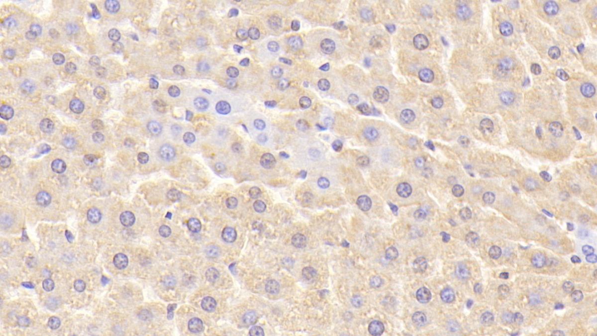 Polyclonal Antibody to Chemokine (C-X-C Motif) Ligand 1 (CXCL1)