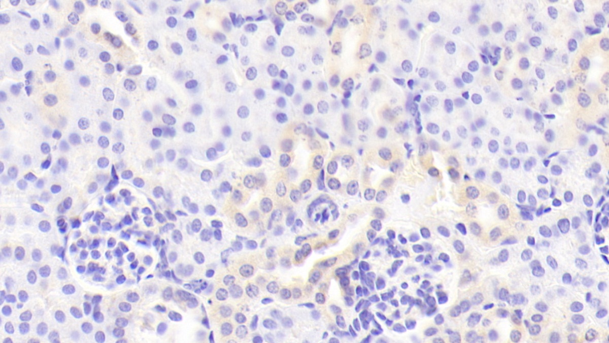 Polyclonal Antibody to Colony Stimulating Factor 2, Granulocyte Macrophage (GM-CSF)