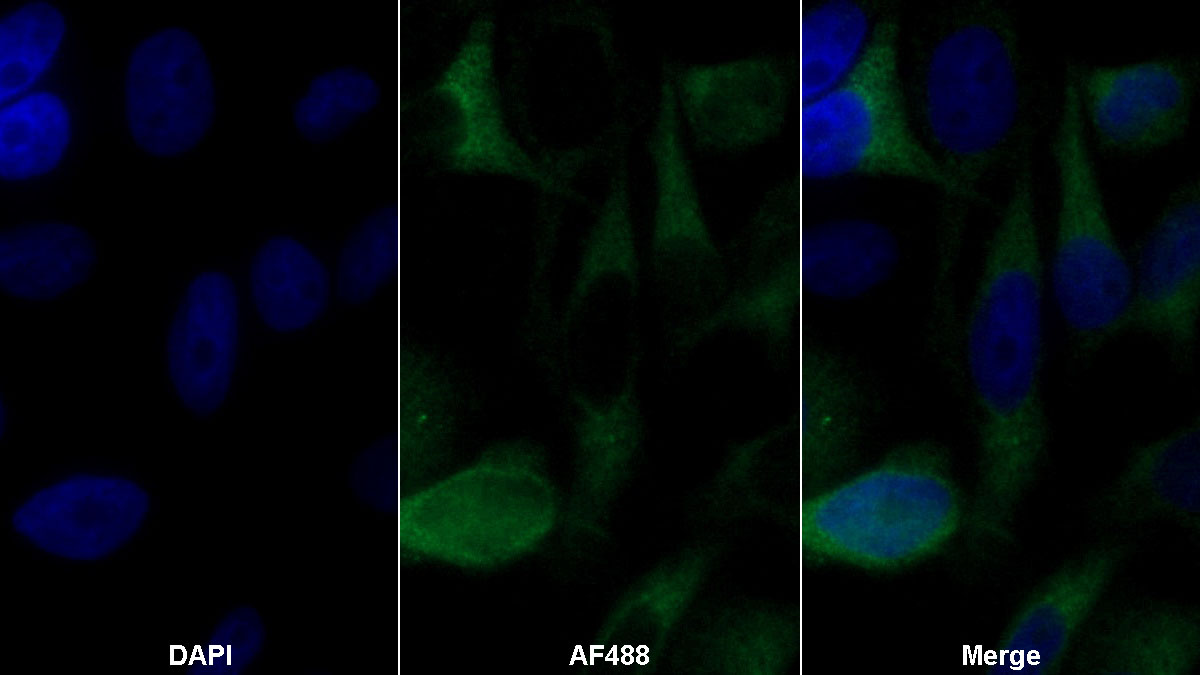 Polyclonal Antibody to Hepatocyte Growth Factor (HGF)