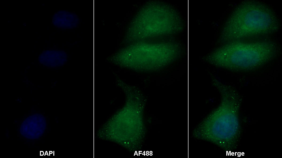 Polyclonal Antibody to Inhibin Beta E (INHbE)