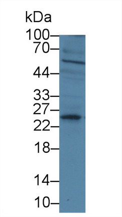 Polyclonal Antibody to Insulin Like Growth Factor 1 (IGF1)