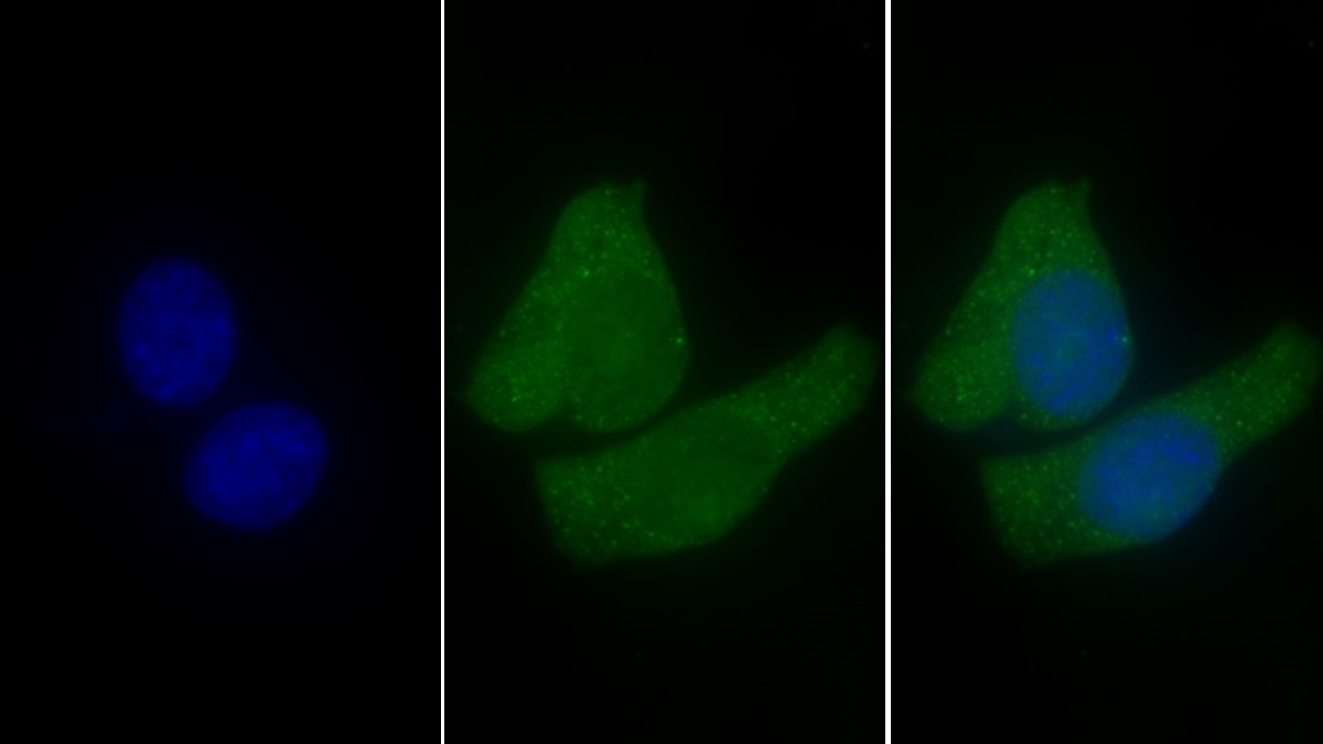 Polyclonal Antibody to Insulin Like Growth Factor 1 (IGF1)