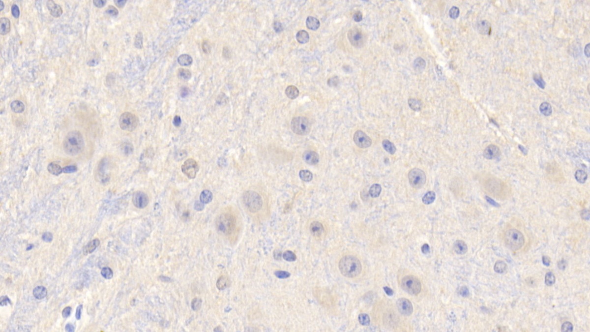 Polyclonal Antibody to Insulin Like Growth Factor 1 (IGF1)