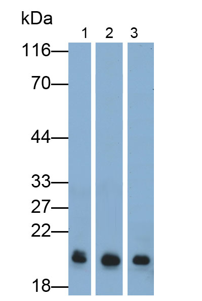 Polyclonal Antibody to Insulin Like Growth Factor 1 (IGF1)