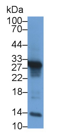 Polyclonal Antibody to Insulin Like Growth Factor Binding Protein 1 (IGFBP1)