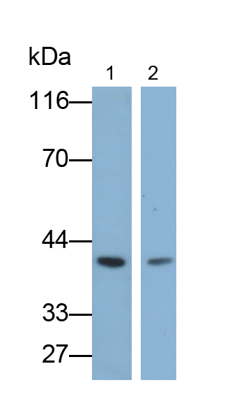 Polyclonal Antibody to Insulin Like Growth Factor Binding Protein 2 (IGFBP2)