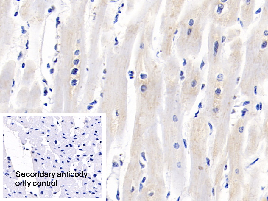 Polyclonal Antibody to Insulin Like Growth Factor Binding Protein 2 (IGFBP2)