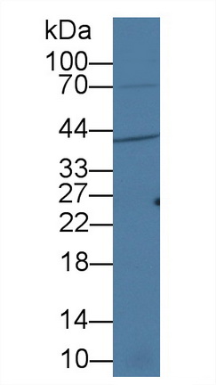 Polyclonal Antibody to Insulin Like Growth Factor Binding Protein 3 (IGFBP3)