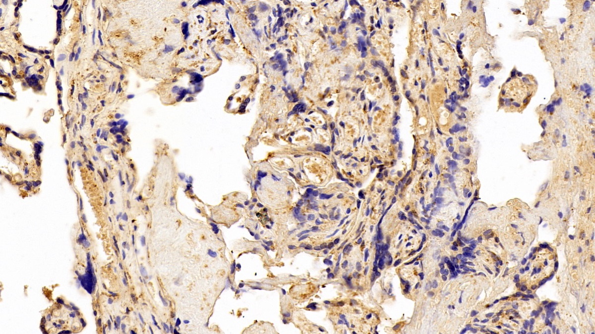 Polyclonal Antibody to Insulin Like Growth Factor Binding Protein 4 (IGFBP4)