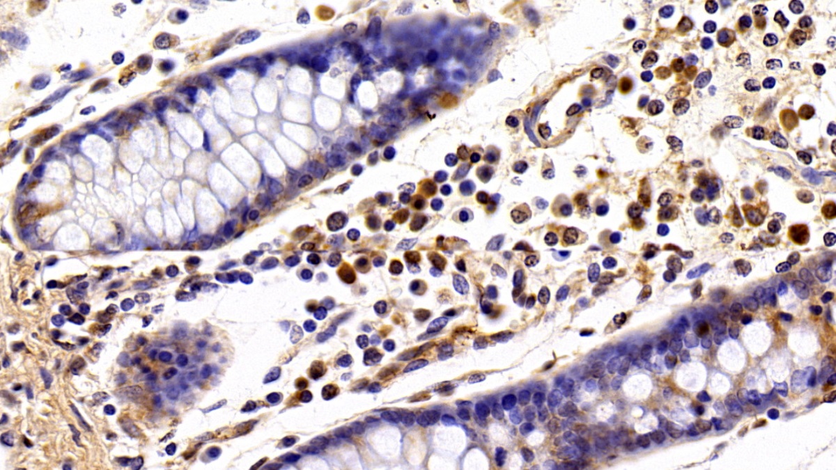 Polyclonal Antibody to Insulin Like Growth Factor Binding Protein 4 (IGFBP4)