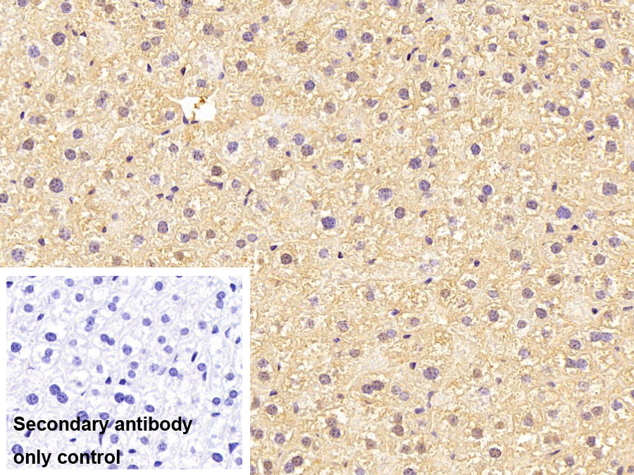 Polyclonal Antibody to Insulin Like Growth Factor Binding Protein 4 (IGFBP4)