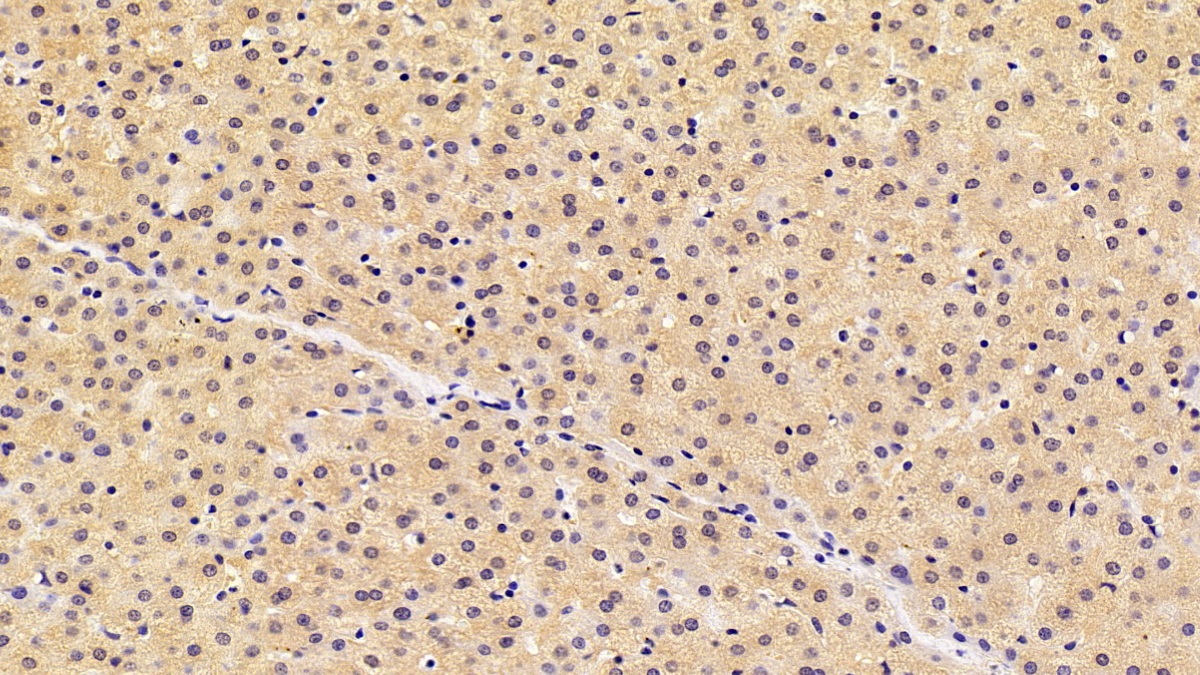 Polyclonal Antibody to Insulin Like Growth Factor Binding Protein 4 (IGFBP4)