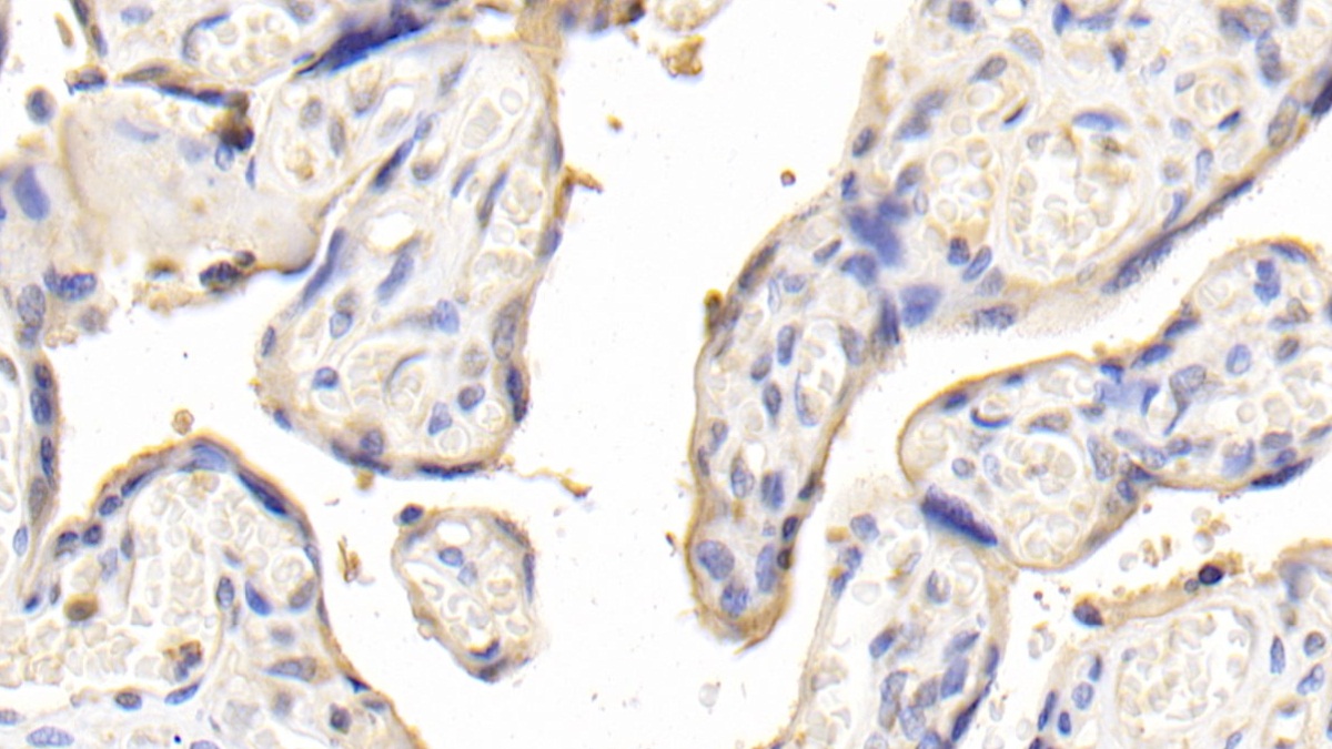 Polyclonal Antibody to Interleukin 12A (IL12A)