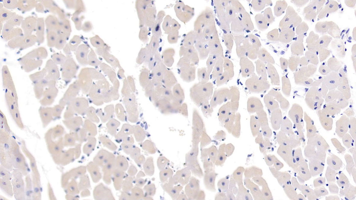 Polyclonal Antibody to Interleukin 13 (IL13)