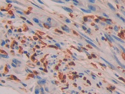 Polyclonal Antibody to Interleukin 16 (IL16)