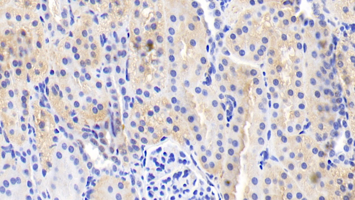 Polyclonal Antibody to Interleukin 18 (IL18)